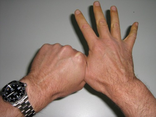 Kicking and breathing baby, but whose left foot is still inside the mother's birth canal.