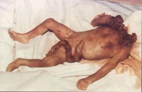 Murdered unborn child